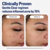 imageCetaphil Face Moisturizer Gentle Clear Mattifying Acne Moisturizer With 05 Salicylic Acid Hydrates and Treats Sensitive Acne Prone Skin Skin Care for Sensitive Skin 3oz