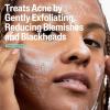 imageCetaphil Gentle Clear Pore Clearing Acne Cleanser Foaming Gel Cleanser for Sensitive AcneProne Skin 8 Fl Oz Pump Bottle 2 Salicylic Acid Gently Exfoliates Dermatologist Recommended Brand