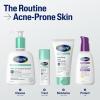 imageCetaphil Gentle Clear Pore Clearing Acne Cleanser Foaming Gel Cleanser for Sensitive AcneProne Skin 8 Fl Oz Pump Bottle 2 Salicylic Acid Gently Exfoliates Dermatologist Recommended Brand