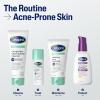 imageCetaphil Gentle Clear ComplexionClearing BPO Acne Cleanser with 26 Benzoyl Peroxide Creamy and Soothing for Sensitive Skin Suitable for All Skin Types 42oz