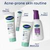 imageCetaphil Gentle Clear TripleAction Acne Treatment Serum with Salicylic Acid Treats and Prevents Acne Great for PostAcne Marks for All Skin Types 1oz